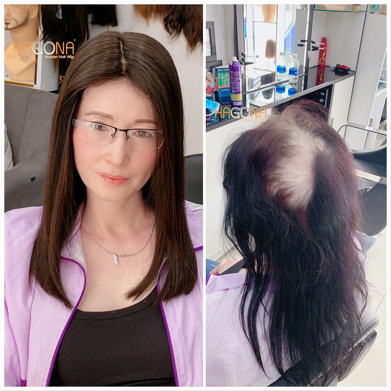 mua tóc giả mái hói nữ 2