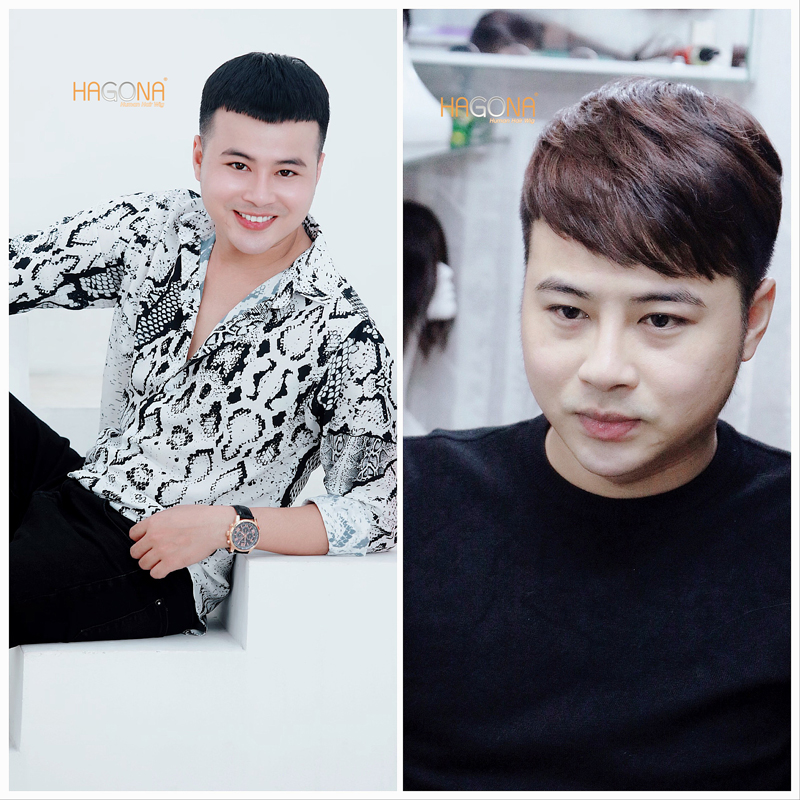 Tóc mái cho người hói trán cao