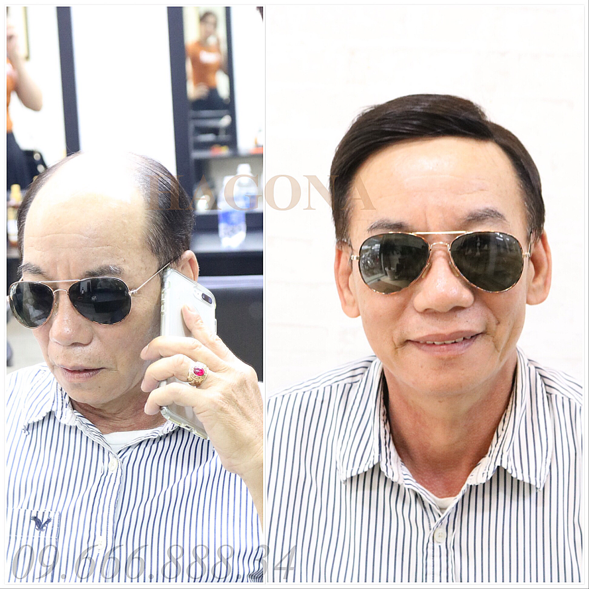 mua tóc giả cho người bạ ung thư