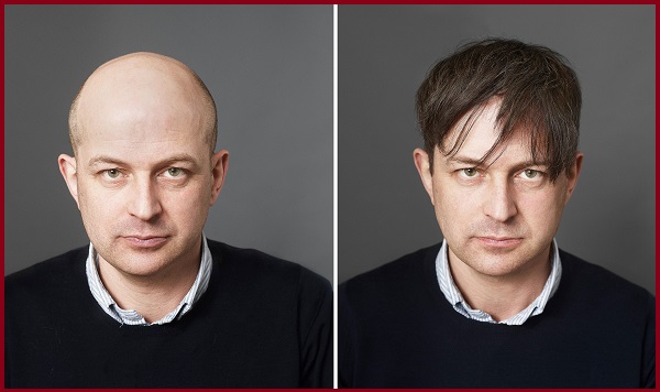 mua tóc giả nam mái hói