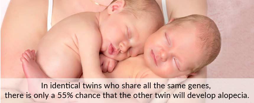 bệnh rụng tóc là gì