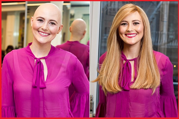 tóc giả cho bệnh nhân ung thư