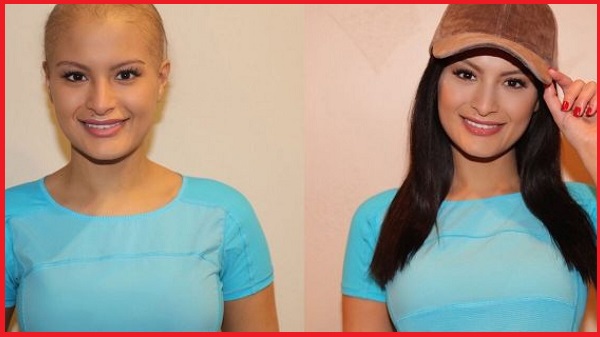 tóc giả cho bệnh nhân ung thư