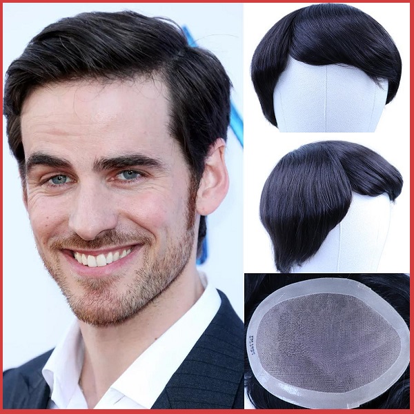 tóc giả mái hói chữ m