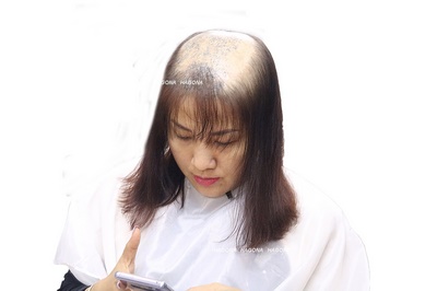 tóc giả bằng tóc thật có da đầu 2