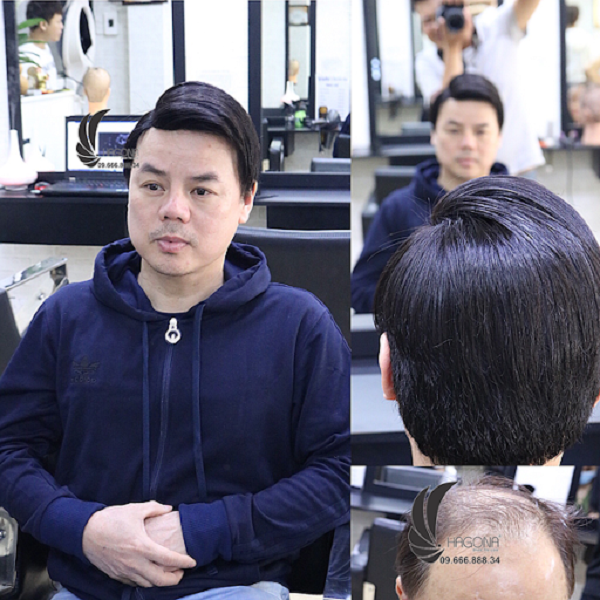 tóc giả nam cả đầu