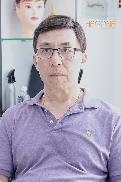 tóc nam che mái hói