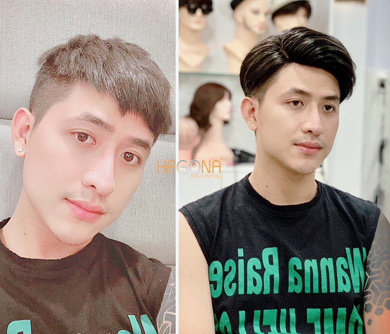 Mẫu tóc giả nam có da đầu đẹp