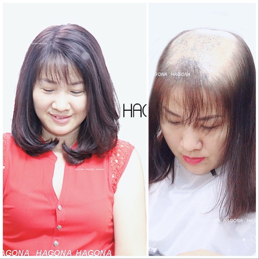 kiểu tóc mái cho người tóc mỏng trán cao 3