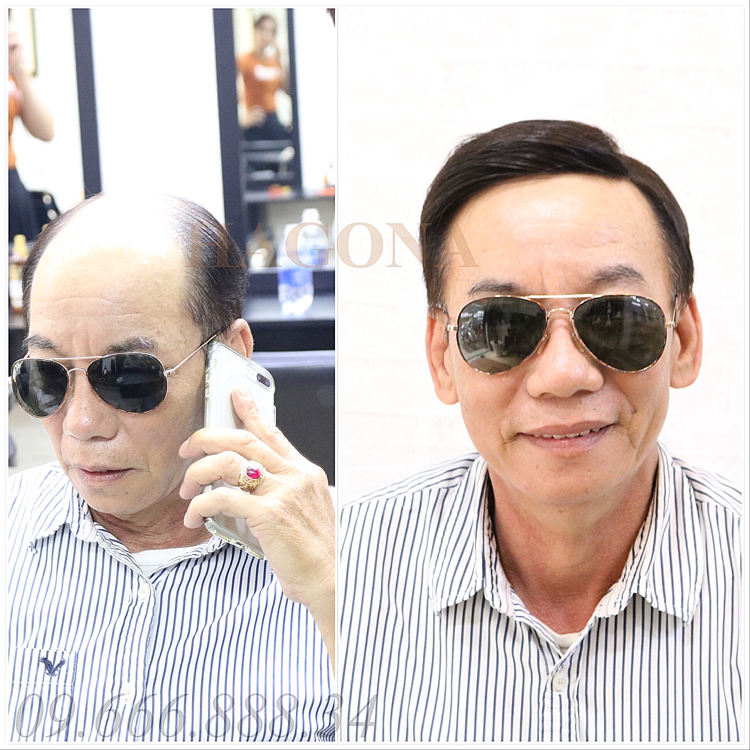 Lợi ích của miếng dán che hói tóc giả nam