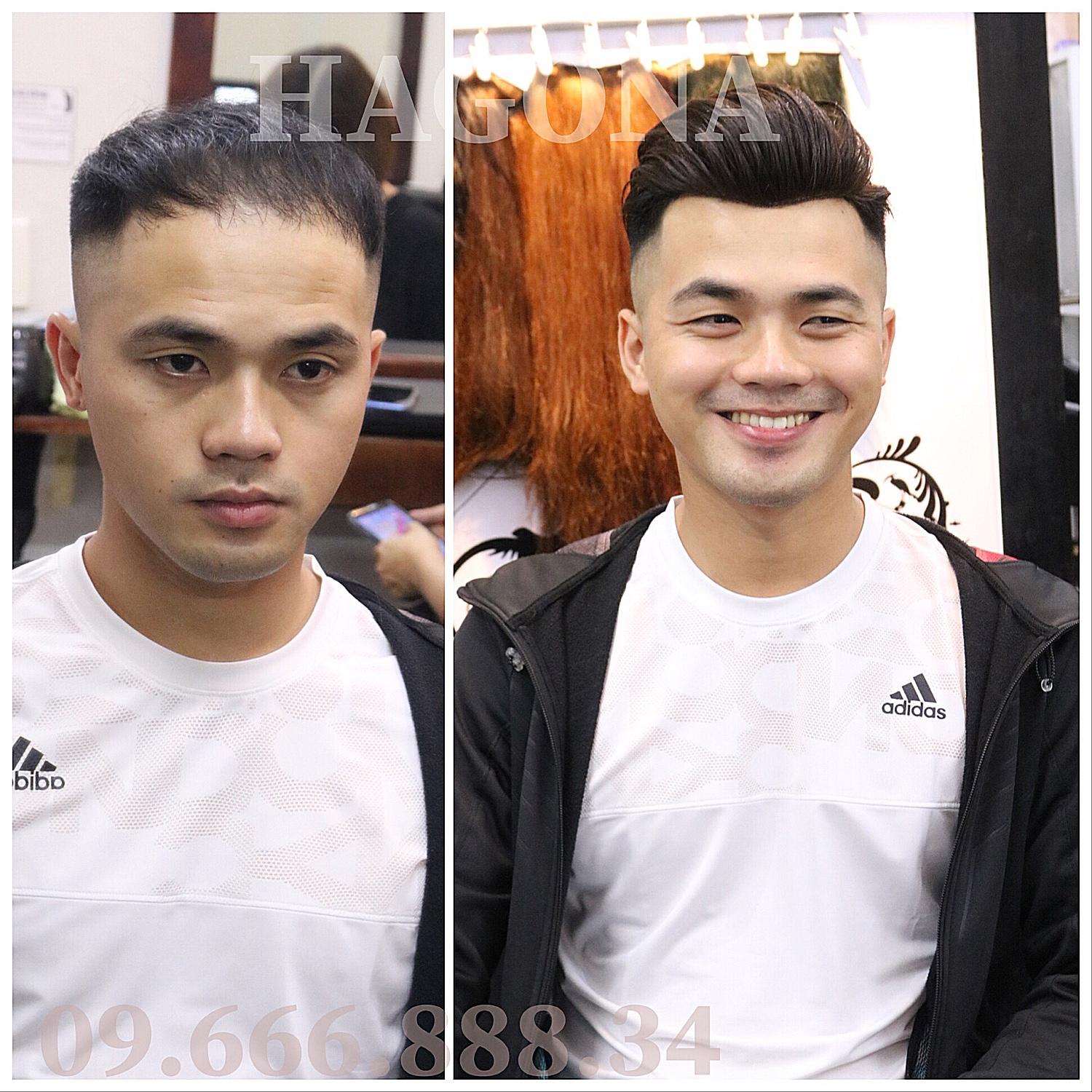 Tư vấn chọn kiểu tóc nam dành cho người hói đẹp phù hợp đẹp nhất