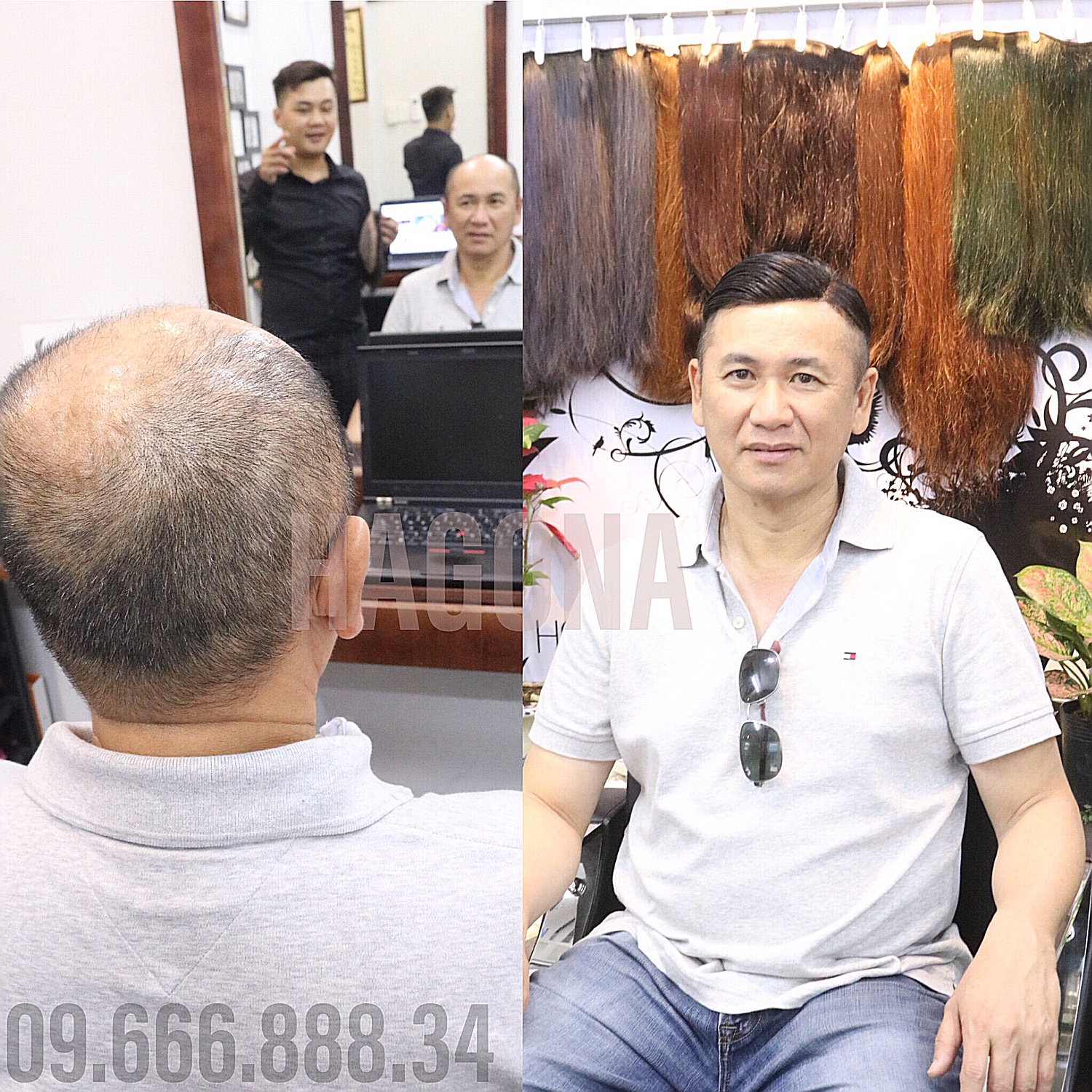 Tại sao bạn nên dùng tóc mái hói giả bằng tóc thật?