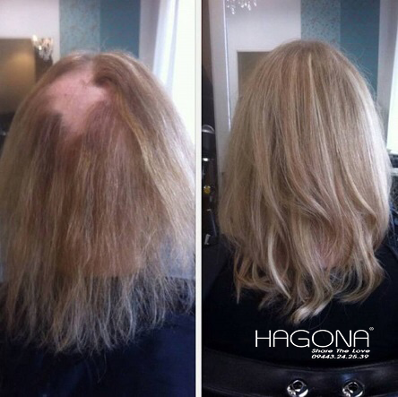 Những tình huống khẳng định tóc mái hói nữ vô cùng có ích