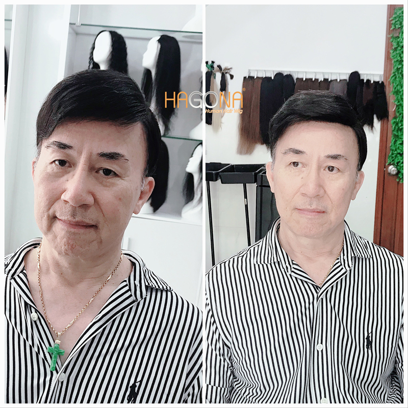 Kiểu tóc cho nam trán hói được yêu thích nhất tại Hagona