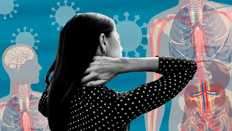 Hậu Covid là gì? Biểu hiện và cách khắc phục di chứng hậu Covid-19