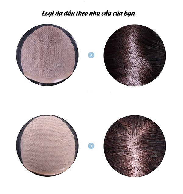 Mua và đội tóc giả