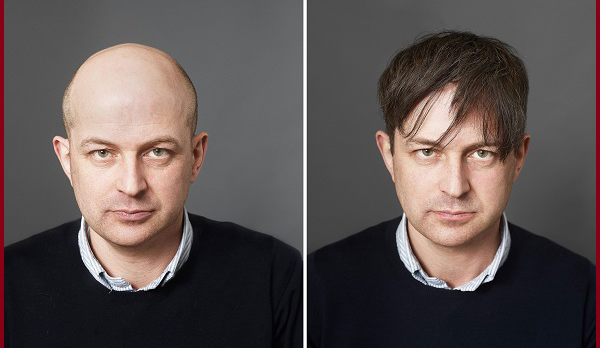 Mua tóc giả nam ở đâu chất lượng, giá tốt nhất? 