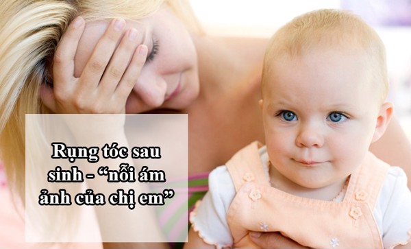 Tóc rụng sau sinh có mọc lại không? Nguyên nhân và cách khắc phục 