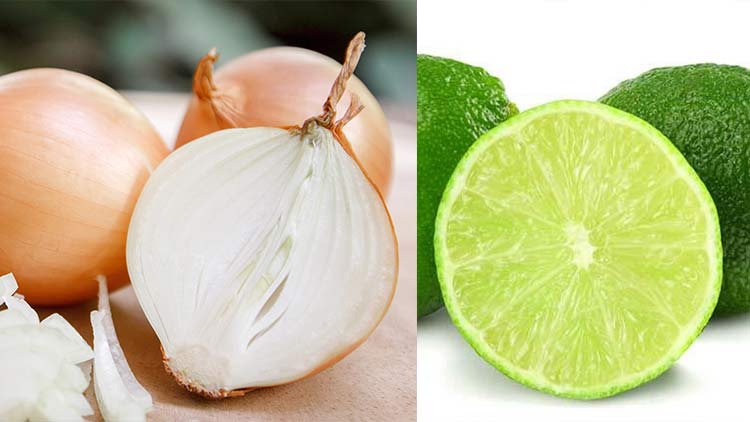 Top 5 cách trị rụng tóc từ nước ép hành tây đơn giản và hiệu quả tại nhà