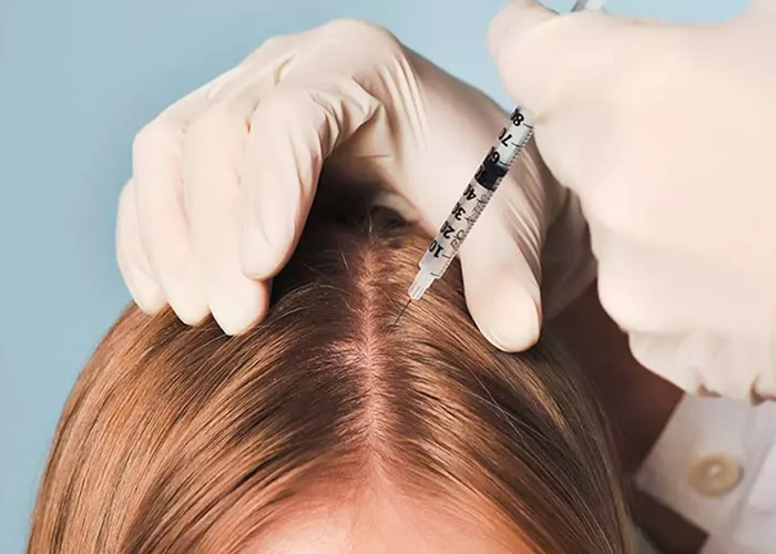 Tổng hợp các phương pháp giảm rụng tóc và kích thích mọc tóc