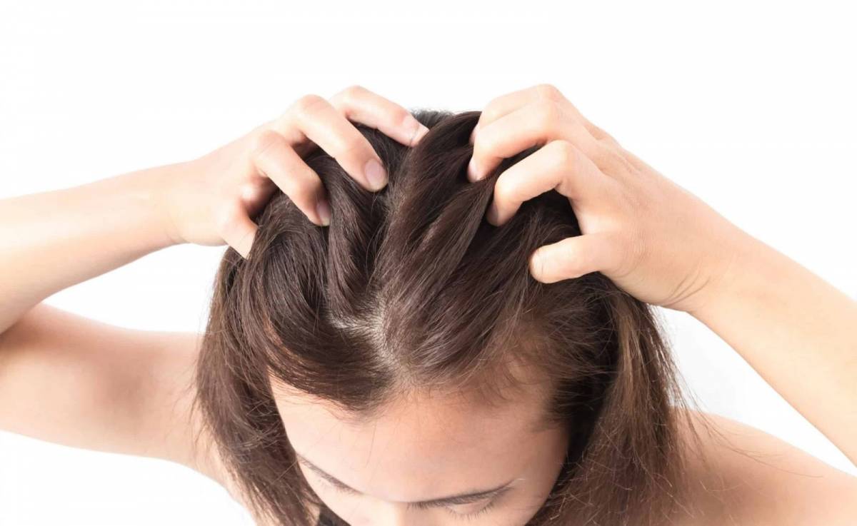 Cách tẩy tế bào chết cho da đầu tại nhà để loại bỏ dầu thừa