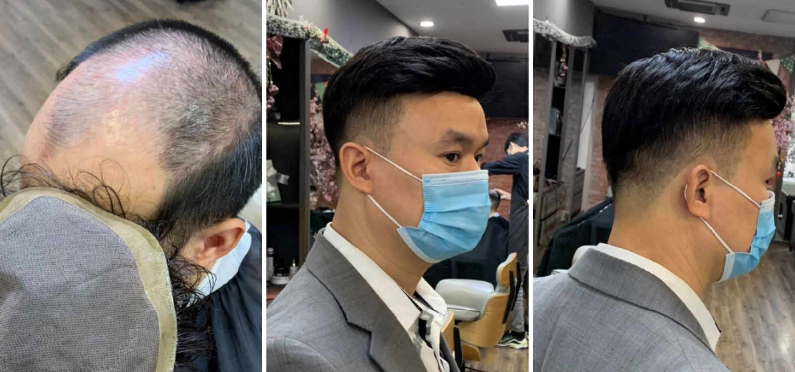 Tóc giả siêu da đầu nam - Must-Have Item của quý ông hiện Đại