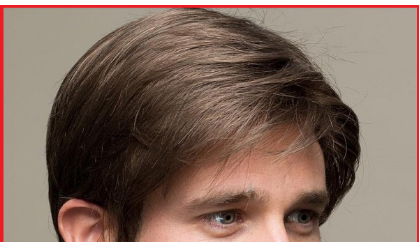 Tóc giả mái hói chữ M: Gợi ý địa chỉ mua sản phẩm chất lượng cao 