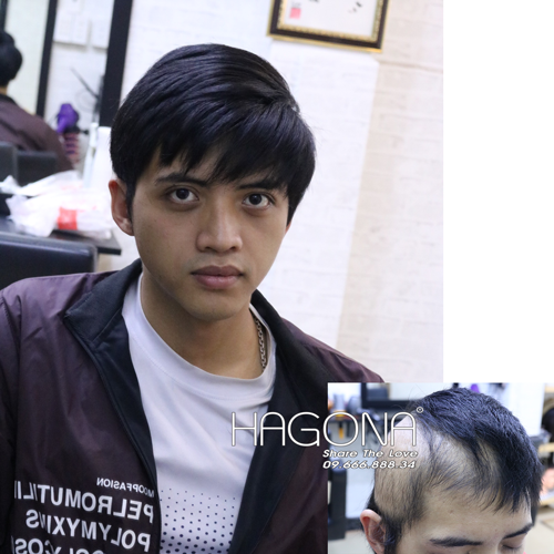 Tóc giả nam cho người bị hói mua ở đâu?